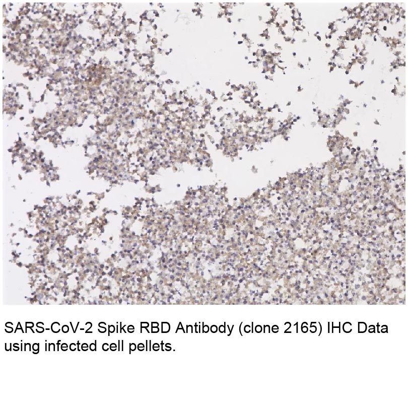 Anti-SARS-CoV Envelope (CT) Anti-SARS-CoV Envelope (CT)