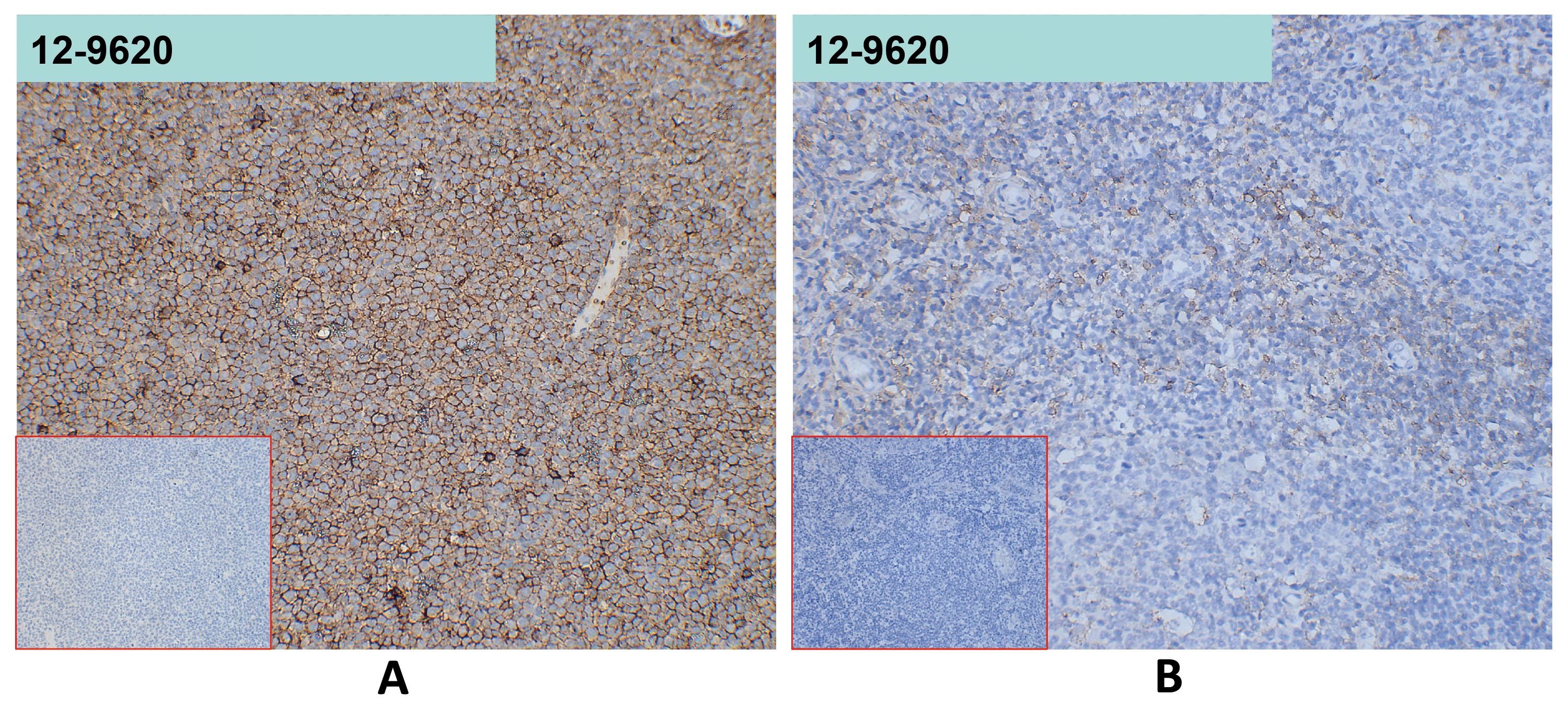 Anti-SELPLG antibody(68H10), IgG1 Chimeric mAb Anti-SELPLG antibody(68H10), IgG1 Chimeric mAb