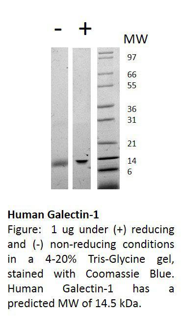 Human Galectin-1 (AF)