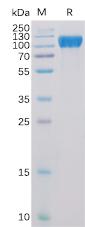 Recombinant Human ACE2 Protein with N-terminal 6Ã—His tag