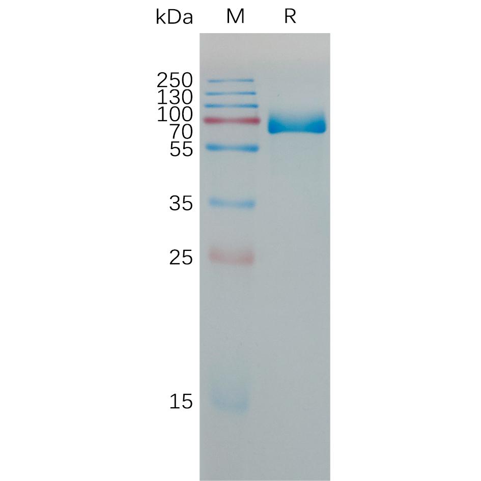 Mouse PD-L1 Protein, hFc Tag