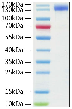 Recombinant Human ACE2 Protein with hFc tag