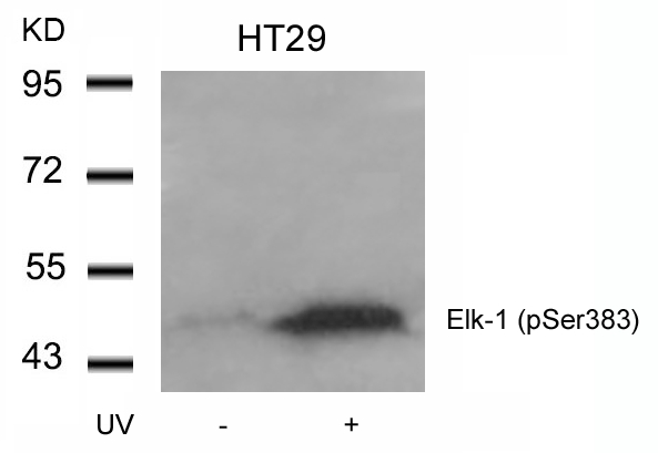 Polyclonal Antibody to Elk-1 (Phospho-Ser383)