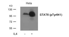 Polyclonal Antibody to STAT6 (Phospho-Tyr641)