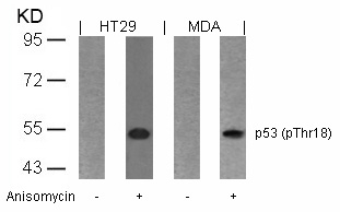Polyclonal Antibody to p53 (Phospho-Thr18)