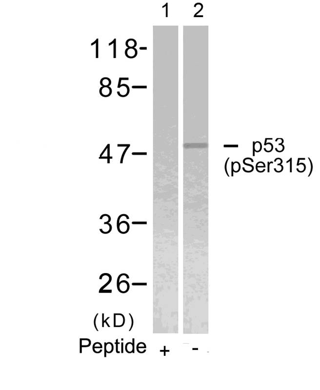 Polyclonal Antibody to p53 (Phospho-Ser315)