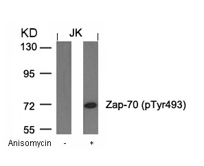 Polyclonal Antibody to Zap-70 (Phospho-Tyr493)