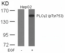 Polyclonal Antibody to PLC Gamma2 (Phospho-Tyr753)