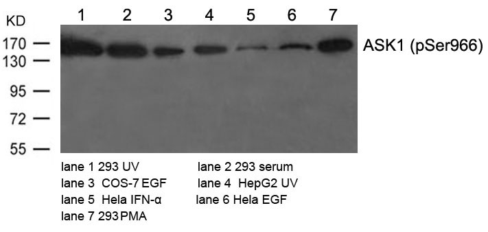 Polyclonal Antibody to ASK1 (Phospho-Ser966)
