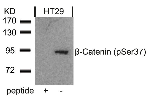 Polyclonal Antibody to beta-Catenin (Phospho-Ser37)