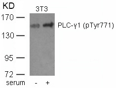 Polyclonal Antibody to PLC- Gamma1 (phospho-Tyr771)