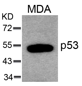 Polyclonal Antibody to p53 (Ab-6)