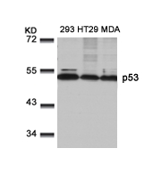 Polyclonal Antibody to p53 (Ab-9)