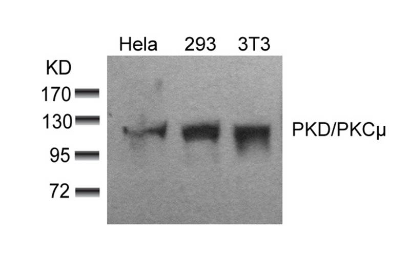 Polyclonal Antibody to PKD/PKC (Ab-910)