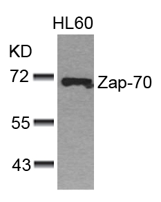 Polyclonal Antibody to Zap-70 (Ab-493)