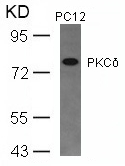 Polyclonal Antibody to PKC Delta (Ab-645)