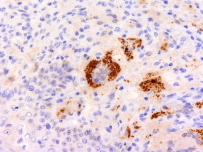 Monoclonal Antibody to TNF-alpha (Tumor Necrosis Factor alpha)(Clone : P/T2)
