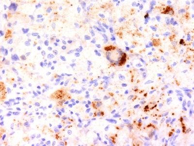 Monoclonal Antibody to TNF-alpha (Tumor Necrosis Factor alpha)(Clone : TNF706)