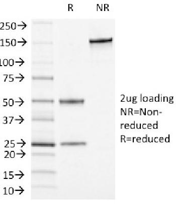 Anti-CD13 / Aminopeptidase-N (Myeloid Cell Marker) Monoclonal Antibody(Clone: APN/1464)