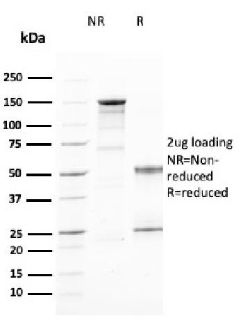 Anti-CD25 / IL2RA (Activated Lymphocyte Marker) Monoclonal Antibody(Clone: IL2RA/2394)
