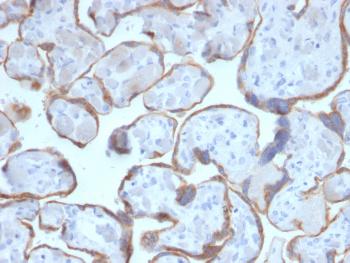 Anti-PAPP-A / Pappalysin-1 (Marker of Atherosclerosis and Aneuploid Fetus) Monoclonal Antibody(Clone: PAPPA/2716)