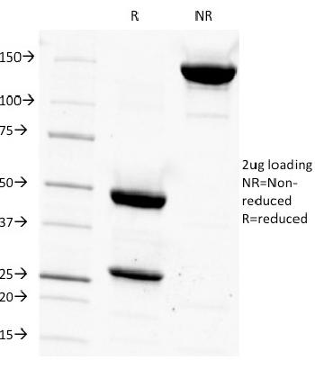 Anti-CD14 (Monocyte / Macrophage Marker) Monoclonal Antibody(Clone: LPSR/927)
