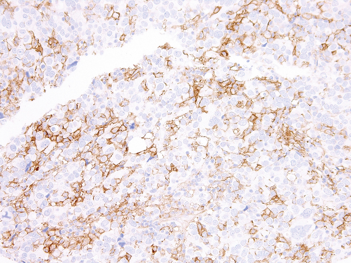 Anti-PD-L1 Rabbit Monoclonal Antibody (Clone:IHC411)