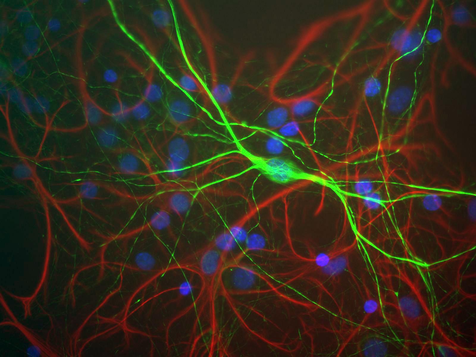 Neurofilament light polypeptide (NF-L), Chicken Polyclonal Antibody