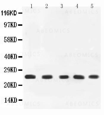 Anti-TNF alpha Antibody | Tnf